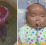7月大婴儿患罕见病欲上海就医遭遇交通障碍 父母哭求寻帮助 - 云南信息港