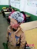 资料图：2018年1月9日，云南昭通一名头顶风霜上学的孩子照片在网上引起广泛关注。文字来源：人民日报 图片来源：视觉中国 - 云南频道